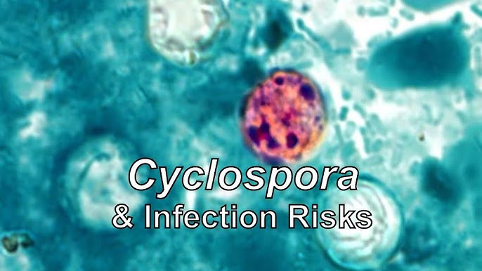 Cyclosporiasis: What You Need to Know About This Parasite Behind Recent Outbreaks
